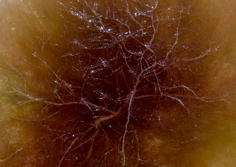 Nucleus