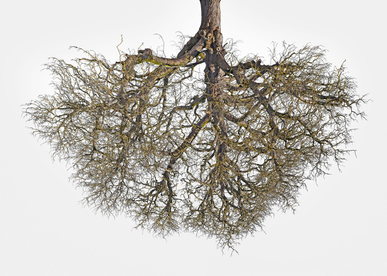 Being 48°2'10.998" N 11°3'3" E (Tree Crowns 10)